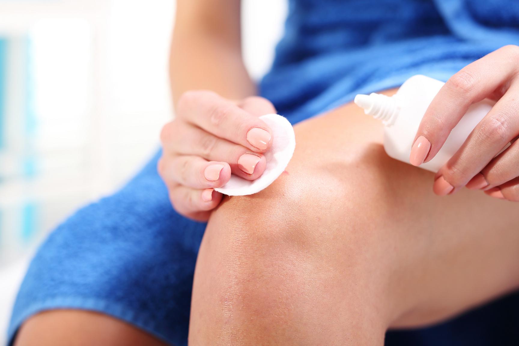 Wound healing